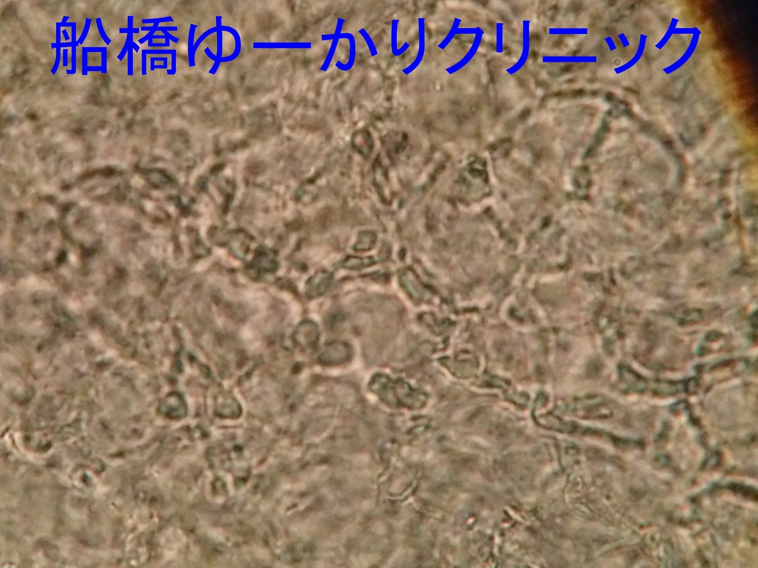 白癬菌