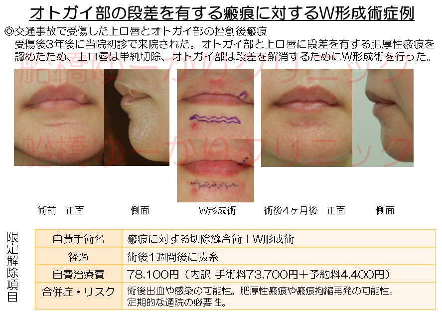 傷跡症例