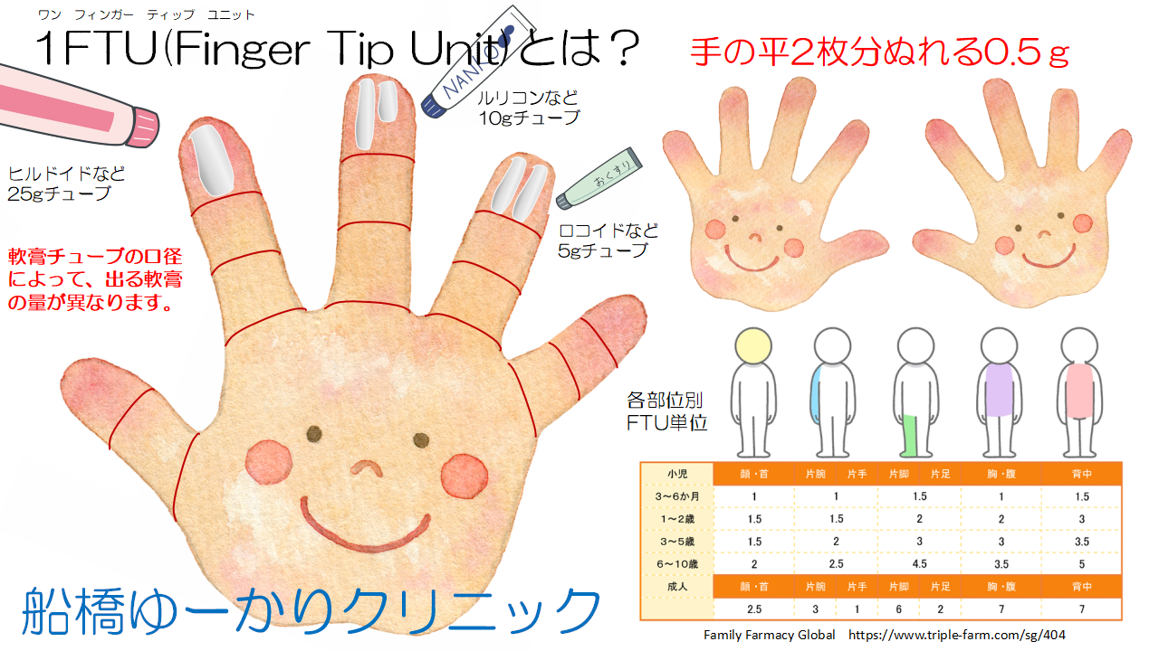 1FTUを説明するイラストを提示しています。
