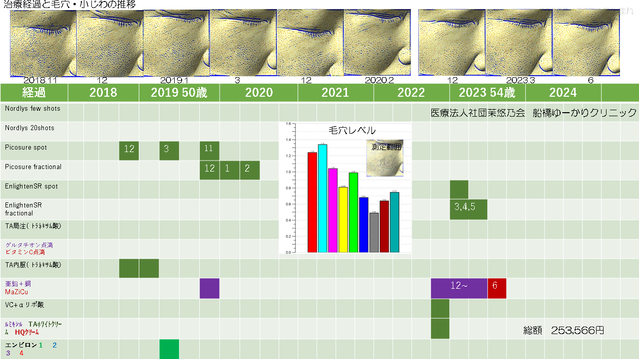 シミ症例１