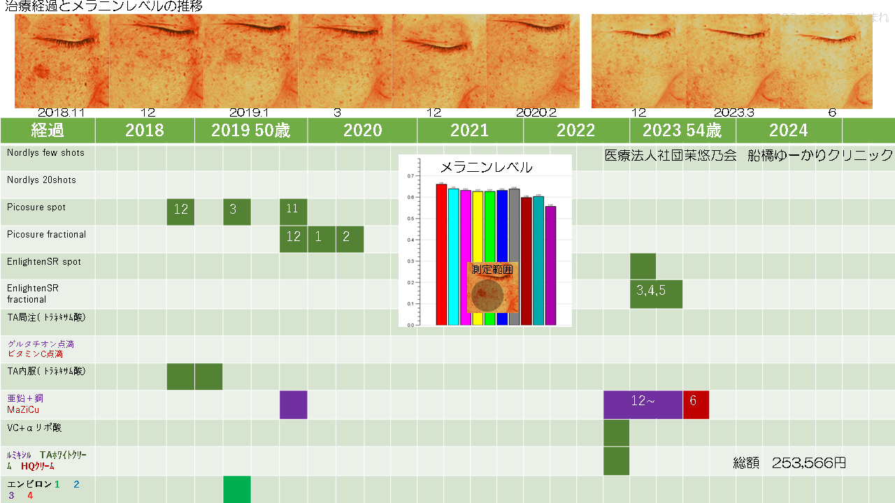 シミ症例１