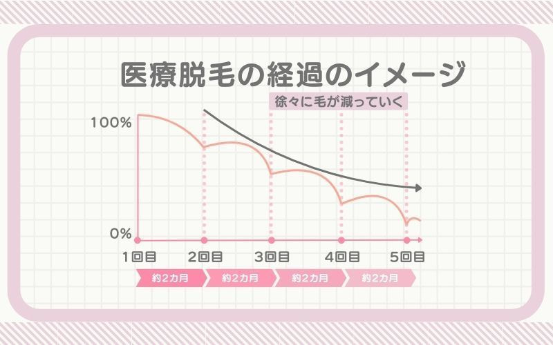 医療脱毛の経過のイメージ