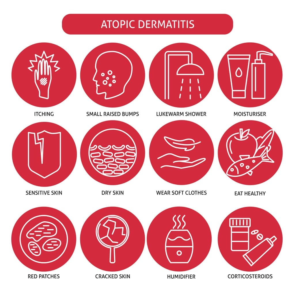 アトピー性皮膚炎イラスト