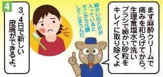 擦過傷イラスト