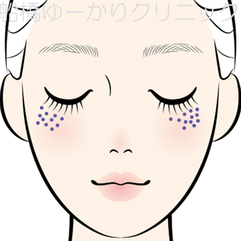 ADMのイラスト