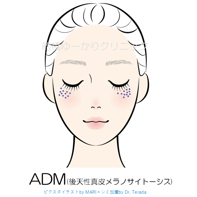 ADMのアイコン