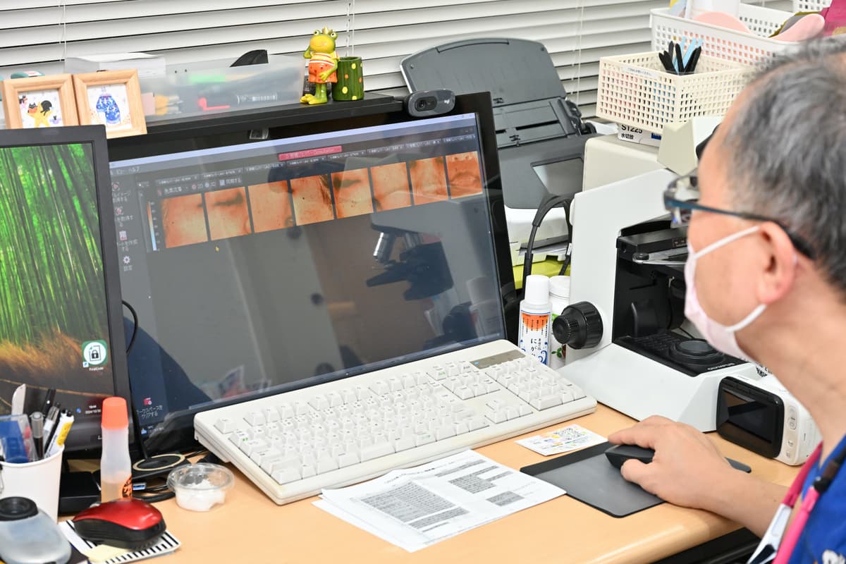 アンテラ３Dによるシミ解析画像一覧表示