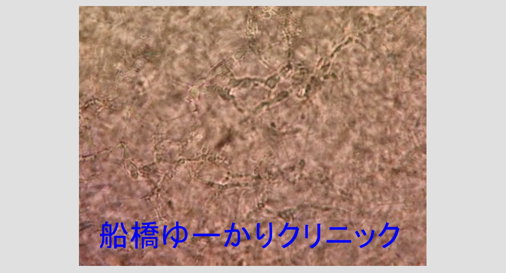 糸状菌の顕微鏡画像