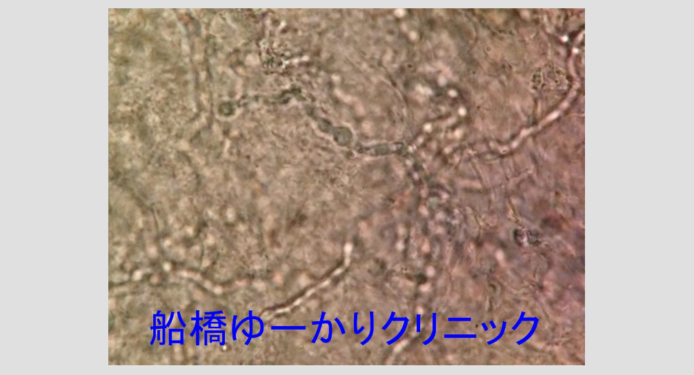 糸状菌の顕微鏡画像