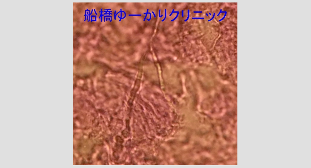 糸状菌の顕微鏡画像
