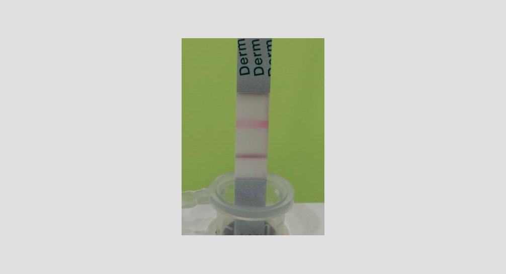 爪白癬 検査キット