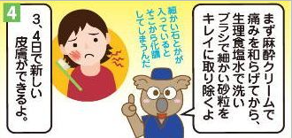 擦り傷の漫画4