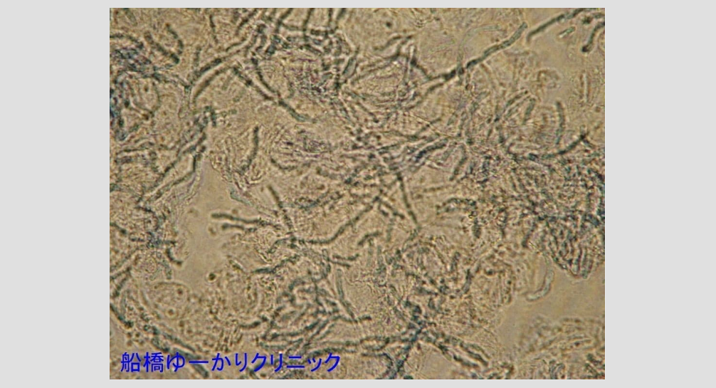 マラセチア 顕微鏡画像2