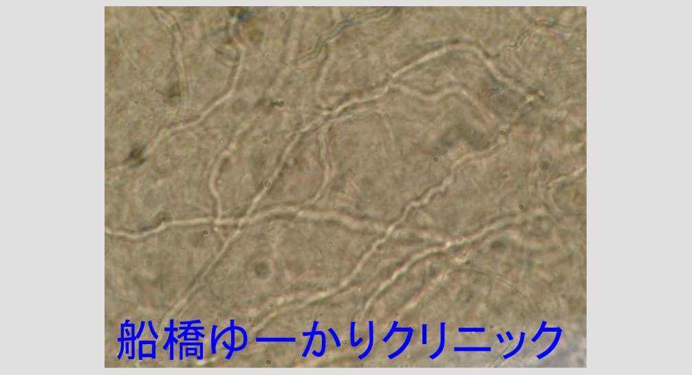 糸状菌 顕微鏡画像1