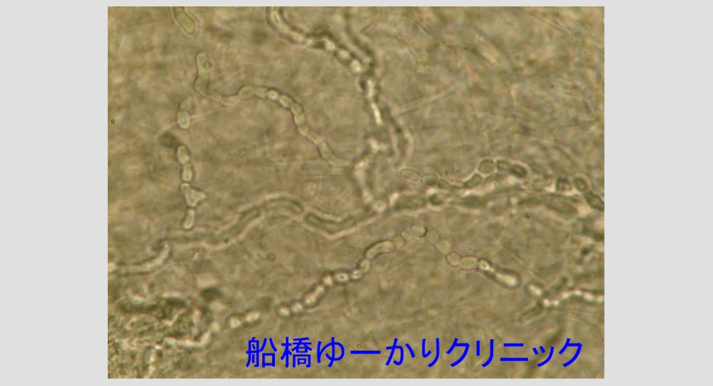 糸状菌 顕微鏡画像2