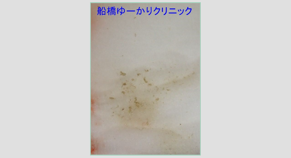 細かい汚れが落ちる